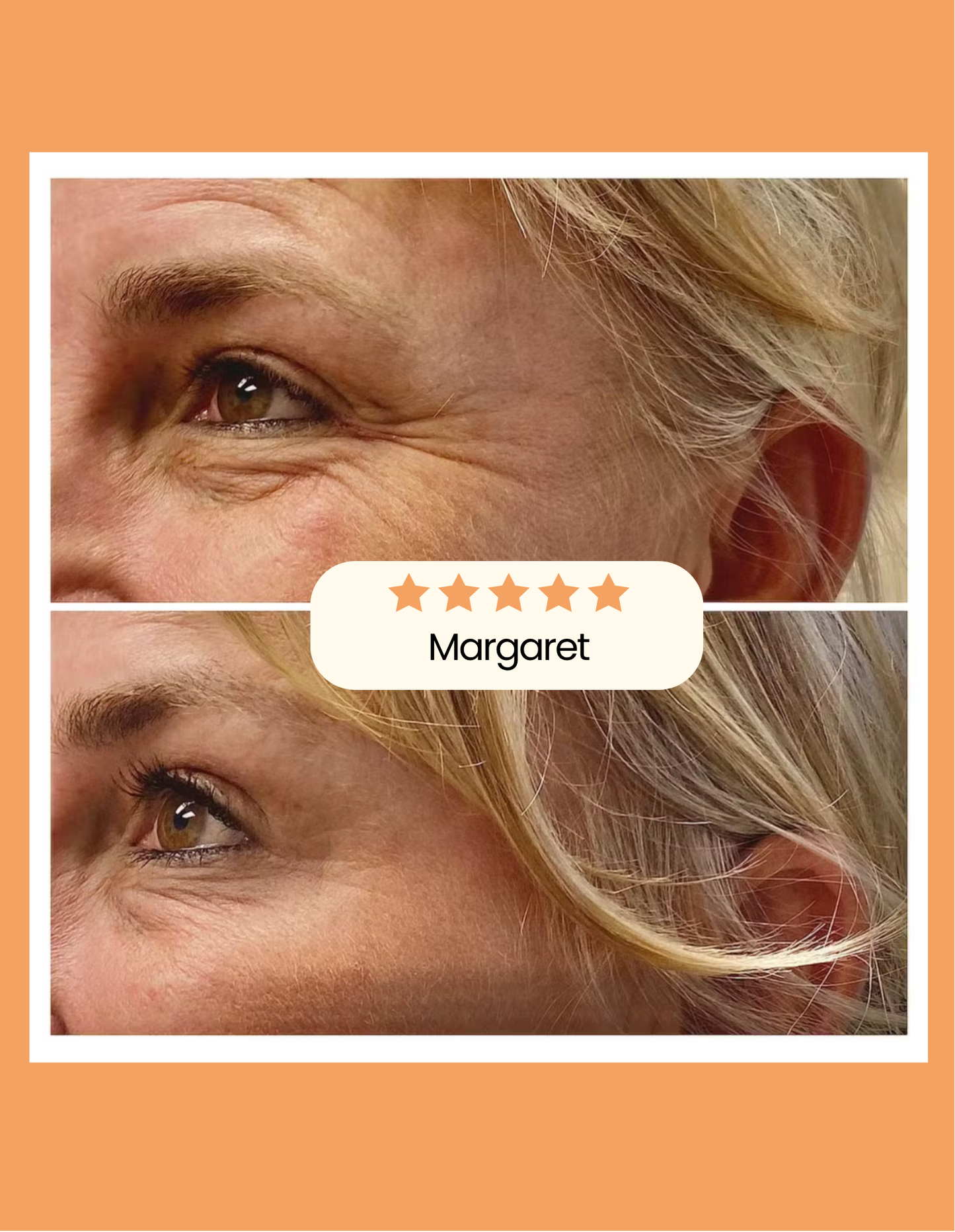 Sakira Beauty - Collagen Patches
