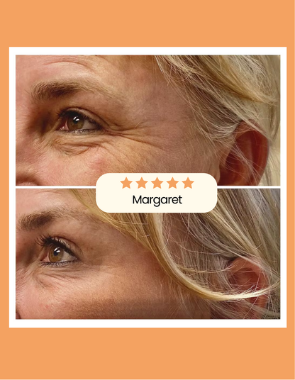 Sakira Beauty - Collagen Patches